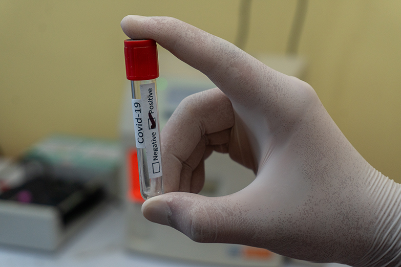 Gloved hand holding vial of blood with a COVID-19 sticker